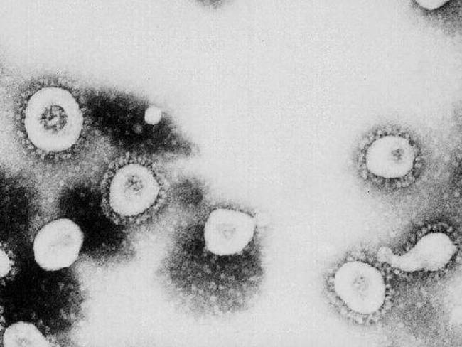 La estructura del coronavirus colapsaría al someterse al ultrasonido.