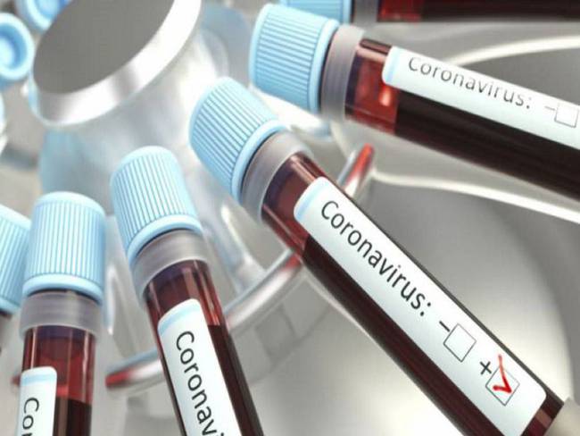 Antioquia ha reducido en un 30% los casos activos de Coronavirus