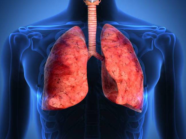 Cáncer de pulmón: su única causa no es el tabaquismo