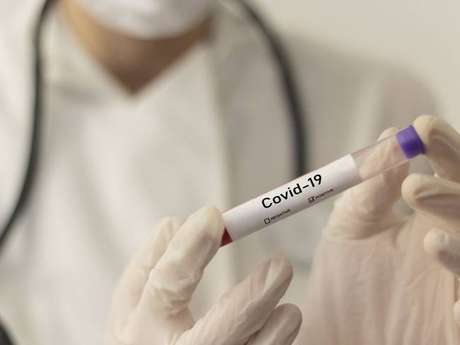 &quot;La vacuna del COVID-19 costaría entre 32 y 37 dólares&quot;: Moderna