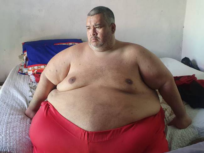 Muere en Cartagena el hombre más obeso de la región Caribe