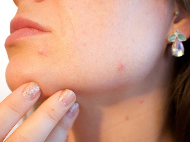 Asocolderma prende las alarmas sobre cuidado de la piel