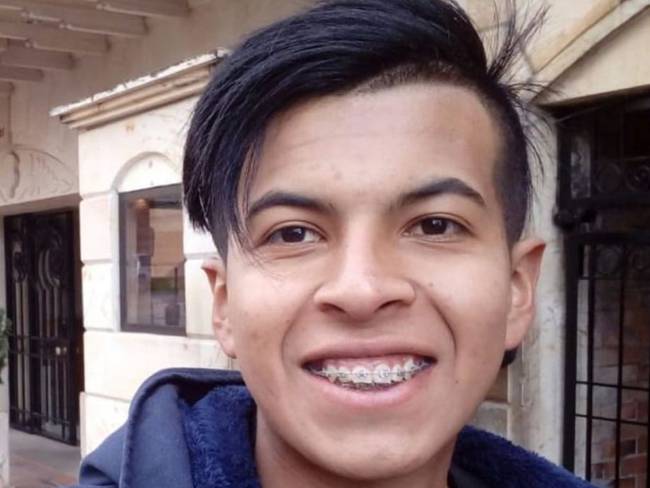 Juan Pablo Fonseca de 25 años, perdió un ojo en medio de manifestaciones 