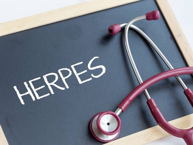Herpes genital - Getty Images