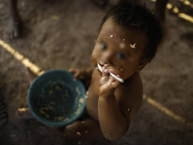 Desnutrición en menores indígenas de Risaralda - Foto: Colprensa