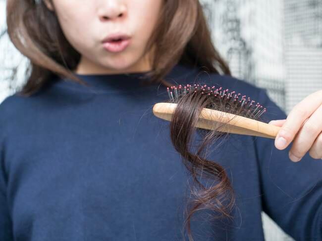 Caída excesiva de cabello podría deberse a la falta de ejercicio físico // Getty Images