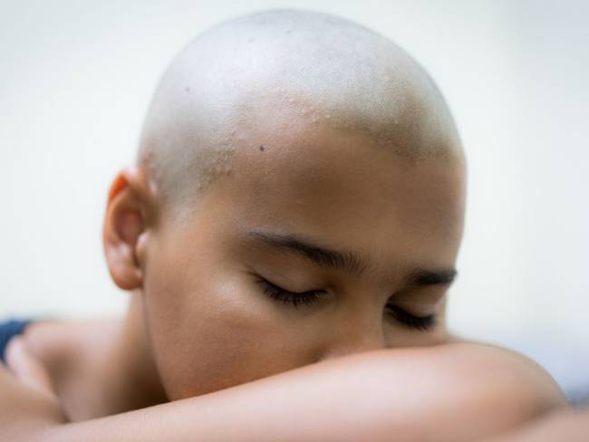 10 señales más frecuentes del cáncer que pueden pasar desapercibidas