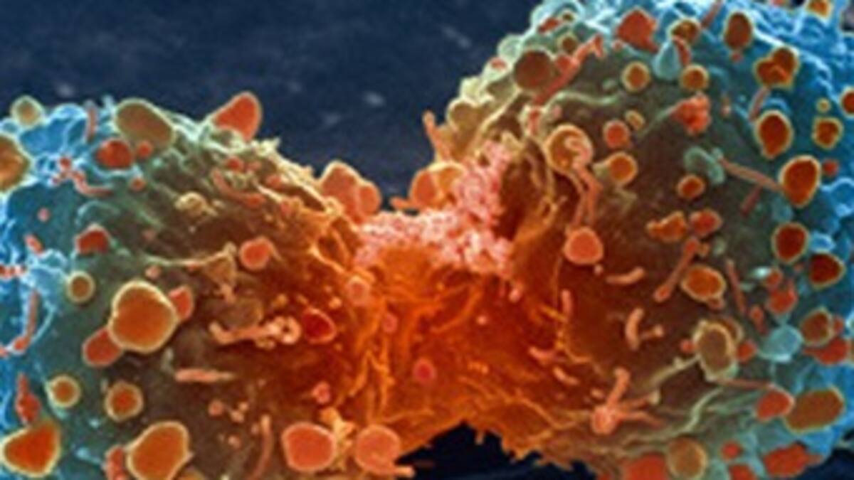 Logran activar el sistema inmune contra el cáncer