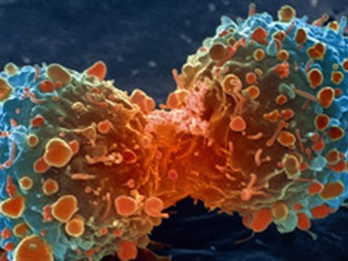 Logran activar el sistema inmune contra el cáncer