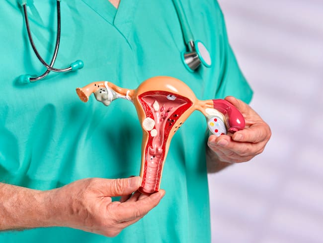 Endometriosis. Imagen de referencia. Foto: Getty Images