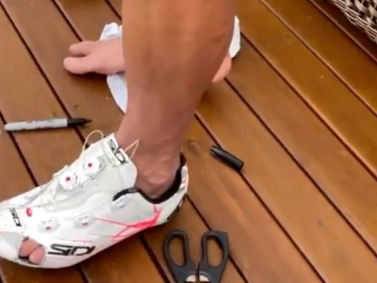 Romper las zapatillas: Solución de Rigo para entrenar con dedo fracturado