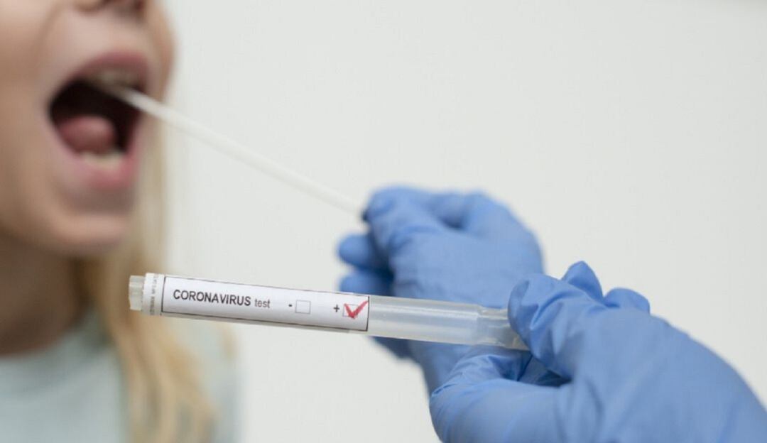Prueba COVID-19