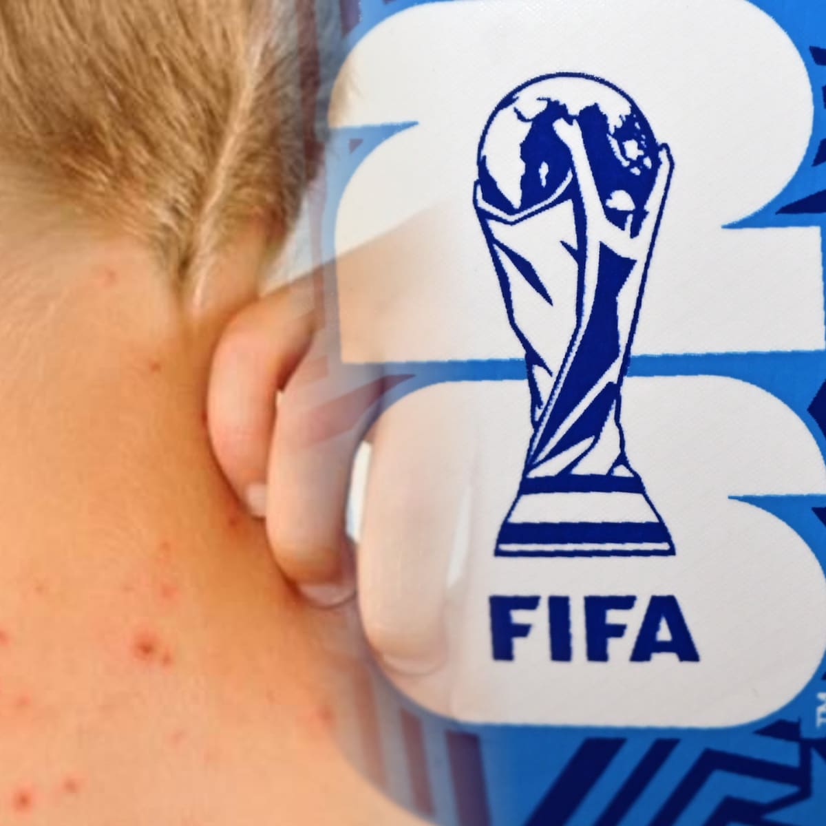 OPS pide reforzar medidas de respuesta al sarampión a días del Mundial de fútbol
