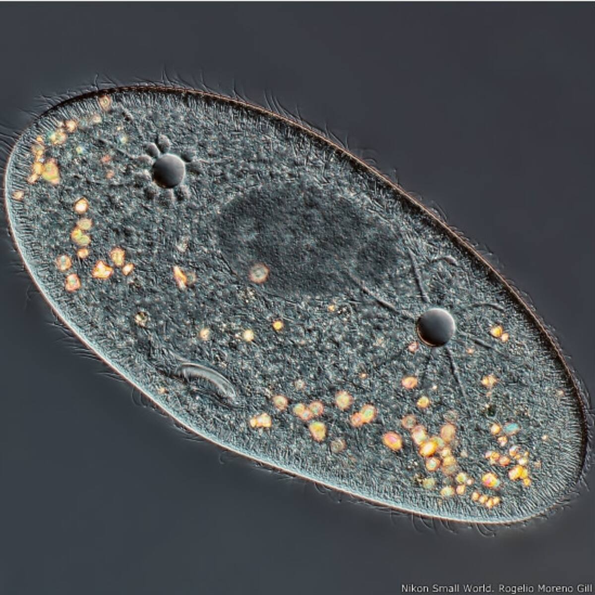 3º - Dr. Alvaro Esteves Migotto, del Centro de Biología Marina de la Universidad de Sao Paulo. Imagen de un gusano marino.