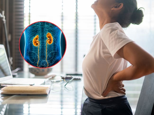 Mujer sintiendo dolor de espalda baja mientras está sentada frente al escritorio / vista de rayos X de los riñones (Getty Images)