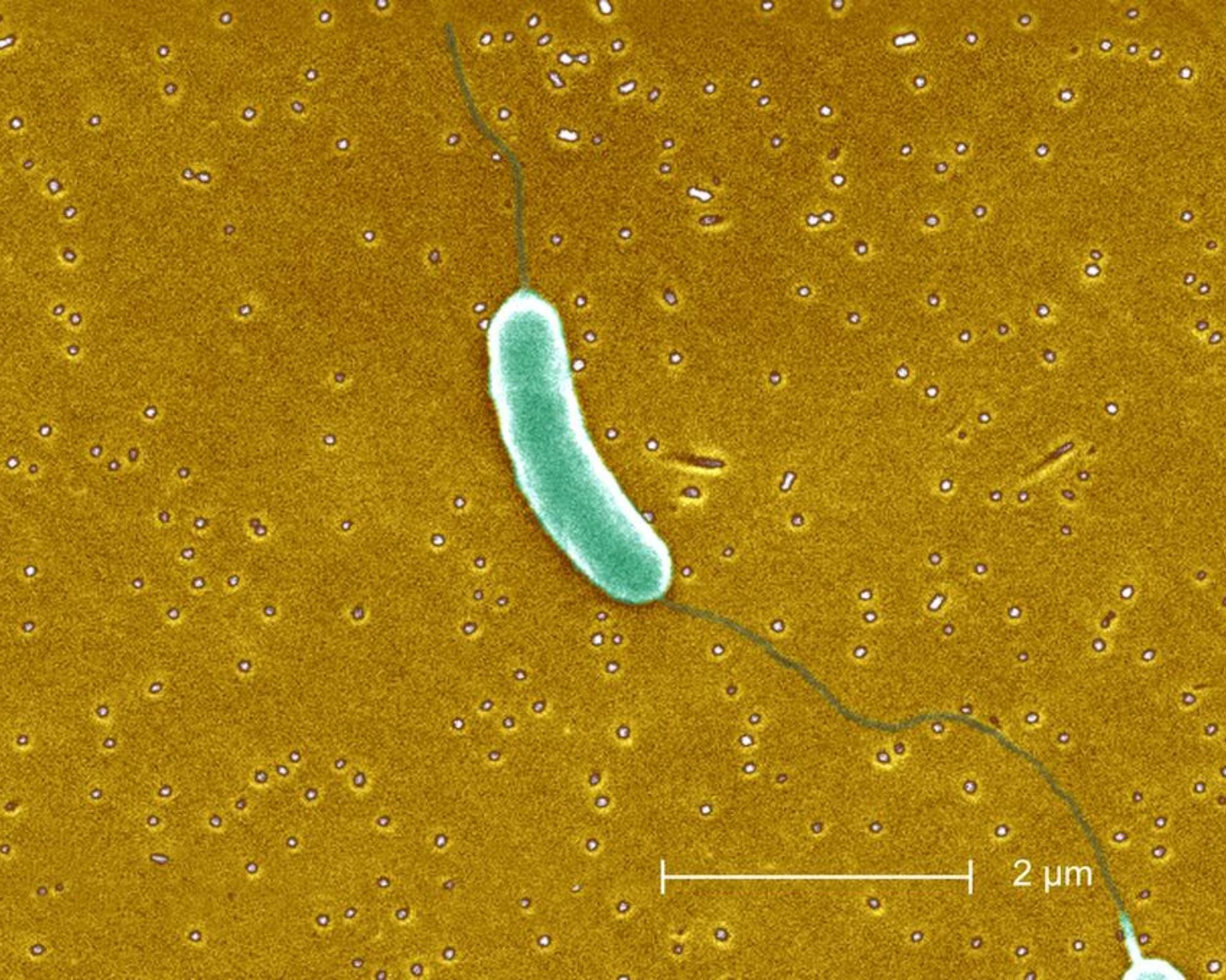Vista de la bacteria Vibrio Vulnificus.
BSIP (Getty Images)