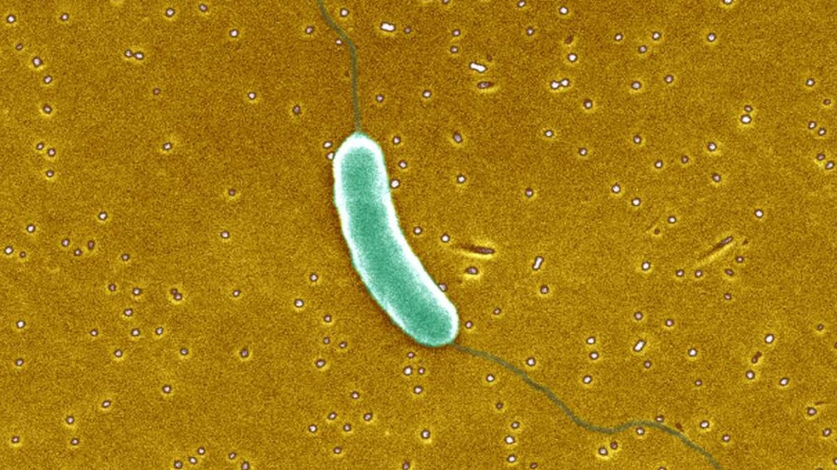 Bacteria ‘come carne’ ha dejado 12 personas muertas en Estados Unidos