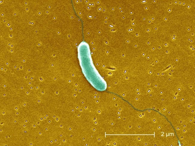 Vista de la bacteria Vibrio Vulnificus.
BSIP (Getty Images)