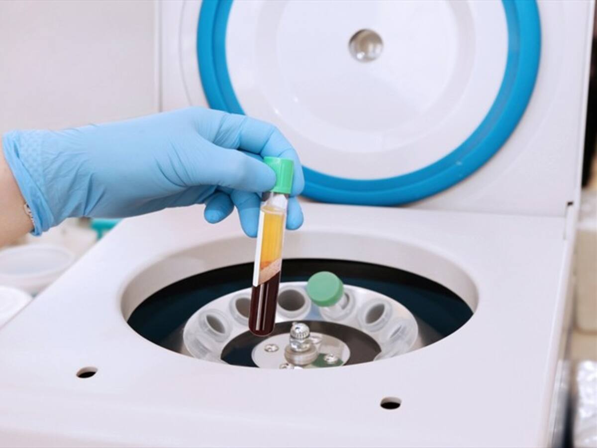 ¿Por qué algunos médicos creen que el plasma puede ser la solución contra el COVID-19?