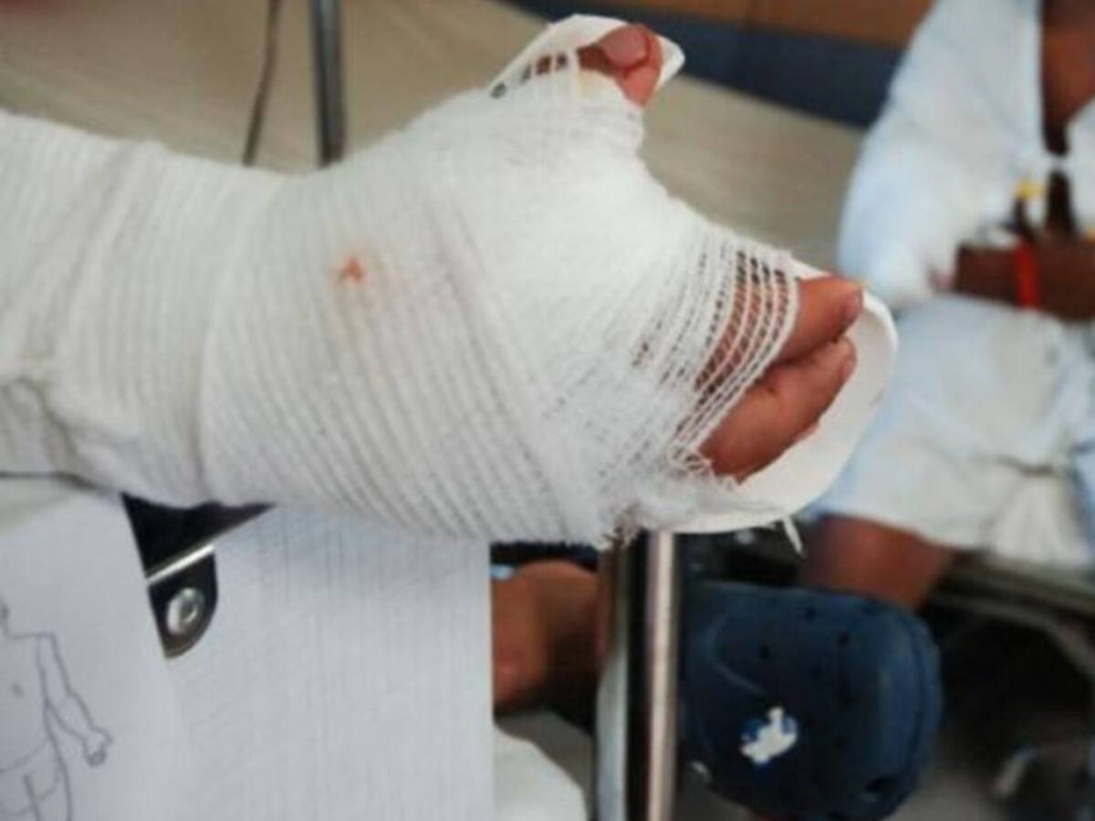 Menor de edad perdió uno de sus dedos por manipular pólvora