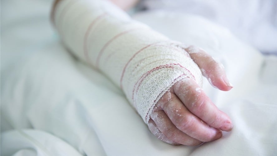 Un niño resultó herido tras manipulación de explosivo en Timbío, Cauca. Foto: Getty Images