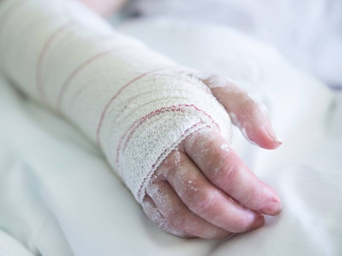 Icbf protege a niño herido por explosivo en Timbío, Cauca