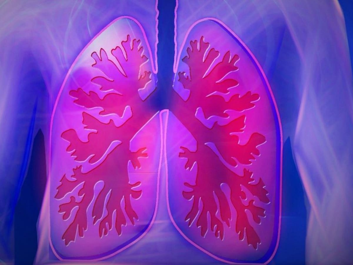 Exponerse al humo de leña o de tabaco, influye en el avance de una enfermedad respiratoria