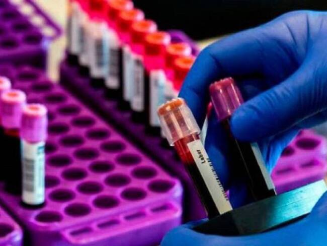 Cali presenta la tasa de contagios de Covid-19 más alta de Colombia