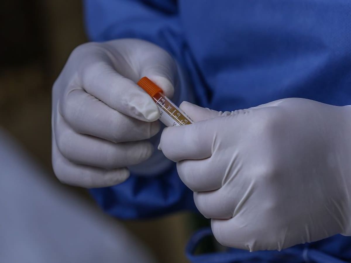 Aumentan contagios, hospitalizaciones y muertes por COVID-19 en Sucre