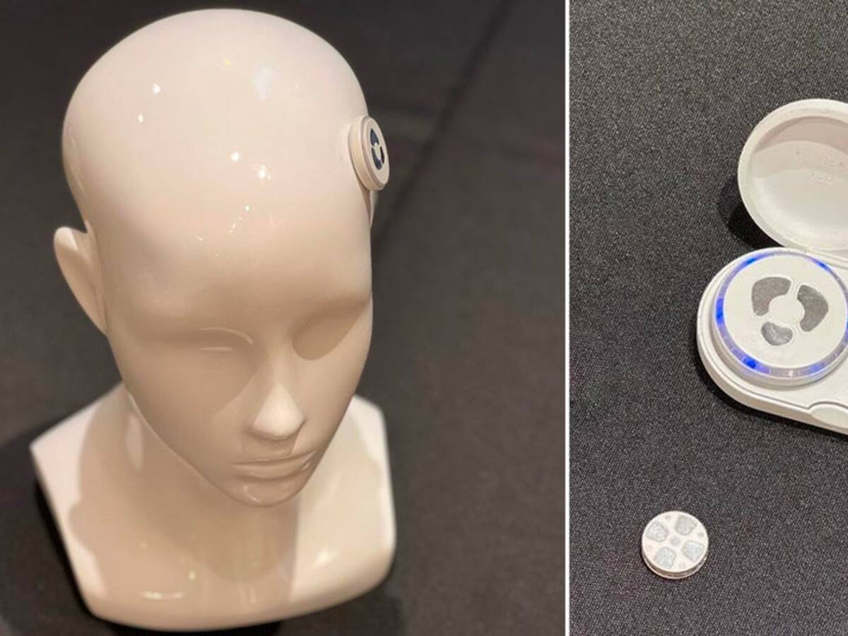 Píldora “digital” para la mente, el implante neural para curar la depresión