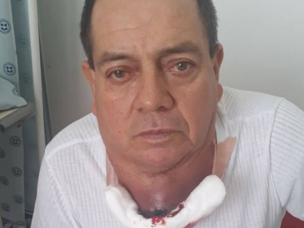 Paciente con tumor maligno en su cuello clama atención urgente