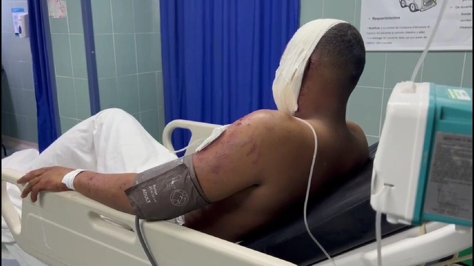 Policía herido en el sur de Bolívar