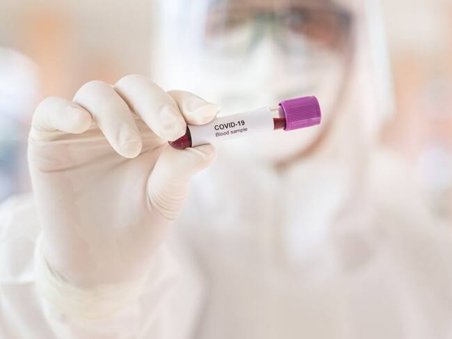 A 133 se eleva el número de casos de COVID-19 en Tolima