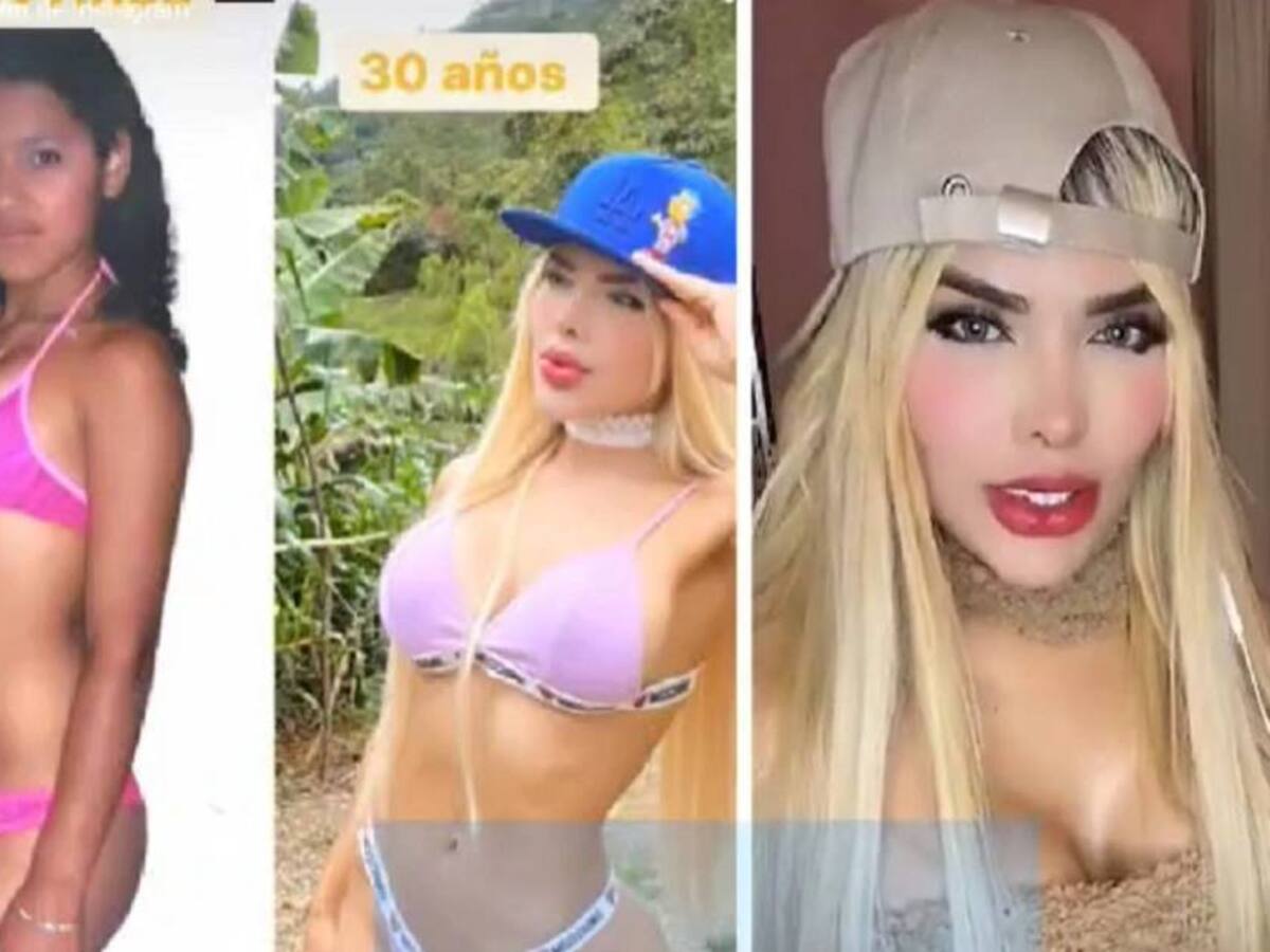 Ella es la 'barbie colombiana', la mujer que le pagó a su hija una rinoplastia