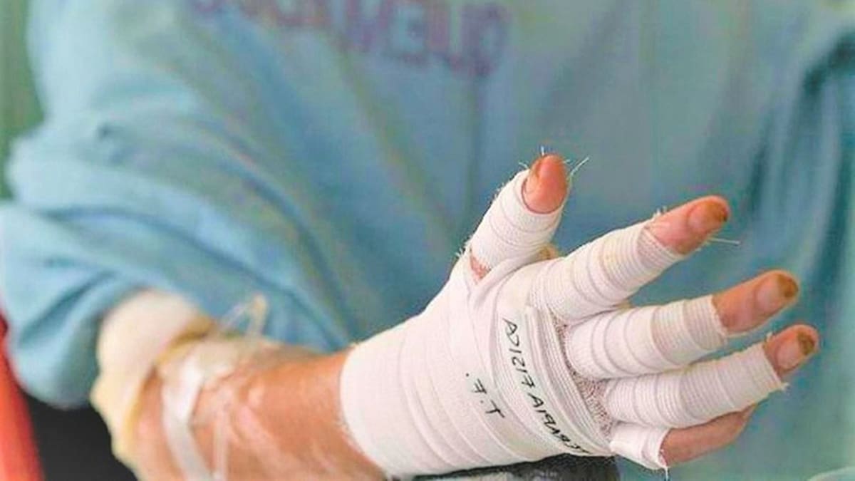 Joven perdió una mano tras la explosión de un artefacto en zona rural de Mistrató, Risaralda