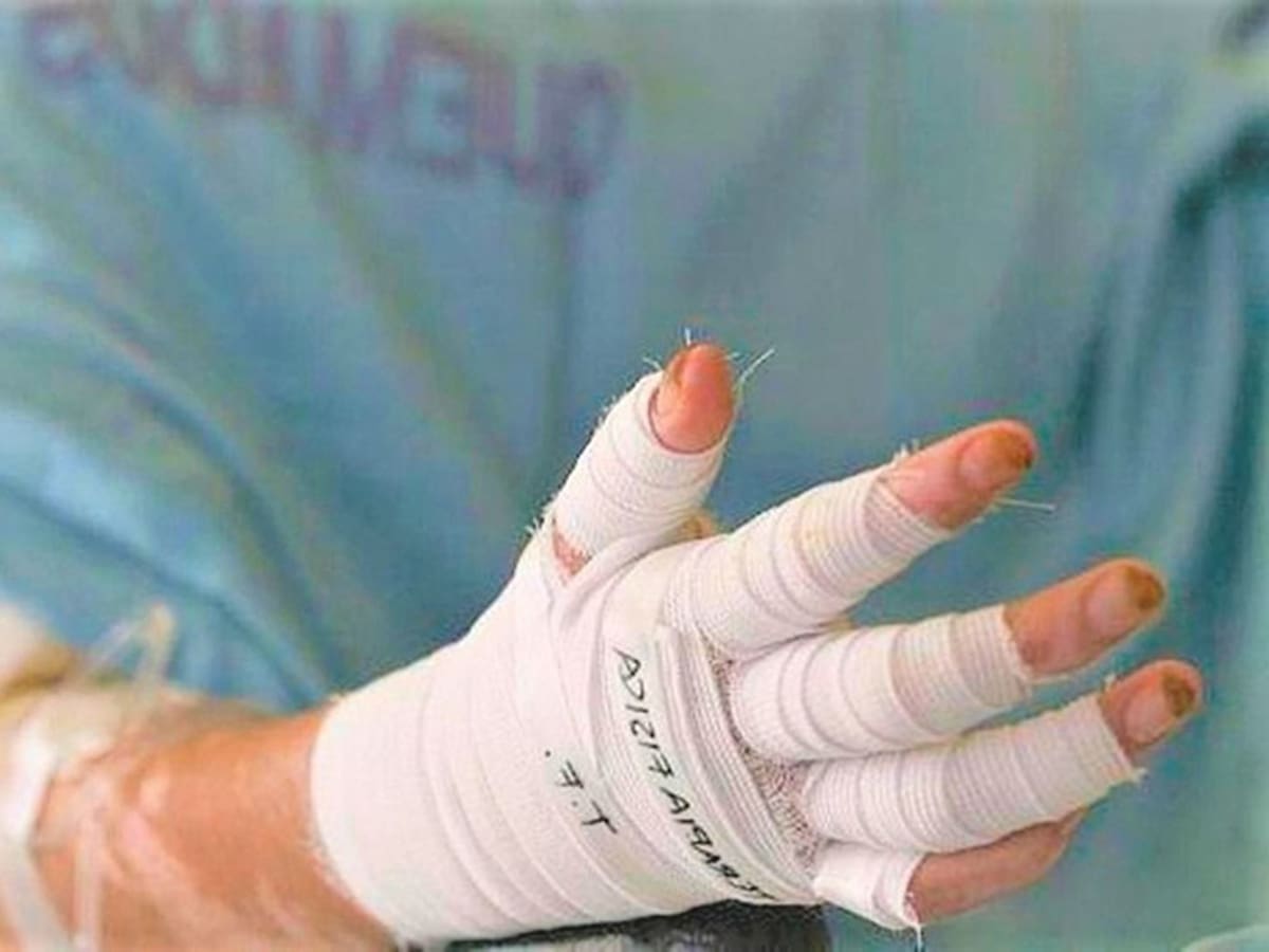 Joven perdió una mano tras la explosión de un artefacto en zona rural de Mistrató, Risaralda