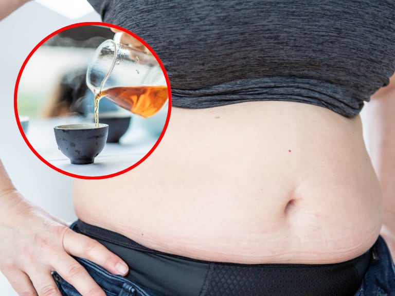 Barriga con infusión, imágenes de referencia // Getty Images