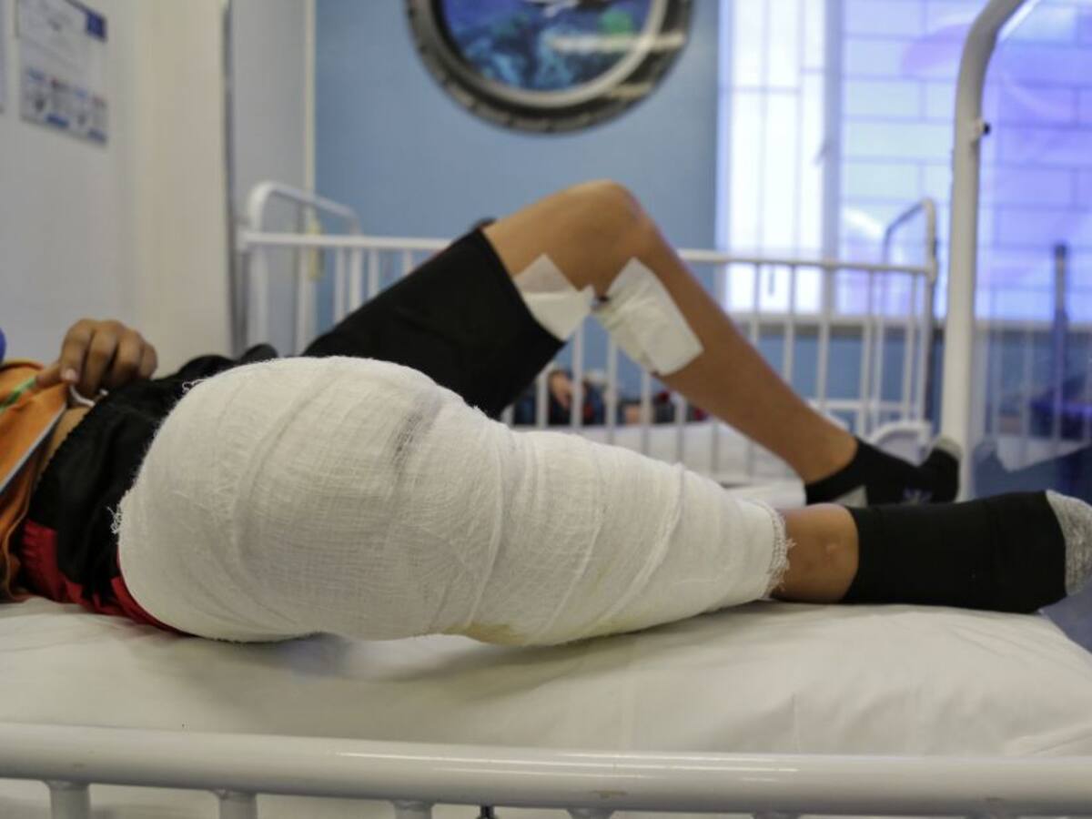 Aumenta el número de quemados con pólvora en Tolima