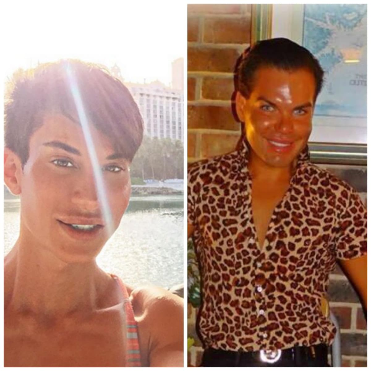 Los dos se han hecho varias cirugías plásticas para parecerse al novio de Barbie. Usted decide cuál está logrando su cometido.