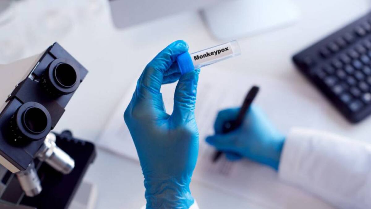 Salud en Cali en alerta ante la llegada de la Viruela del Mono a Colombia