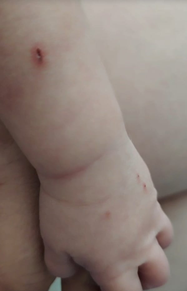 Denuncian presunta negligencia en el Hospital de Moniquirá: bebé habría recibido medicamento equivocado y terminó en UCI neonatal