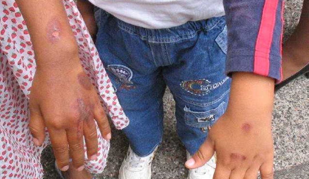 Imagen de referencia