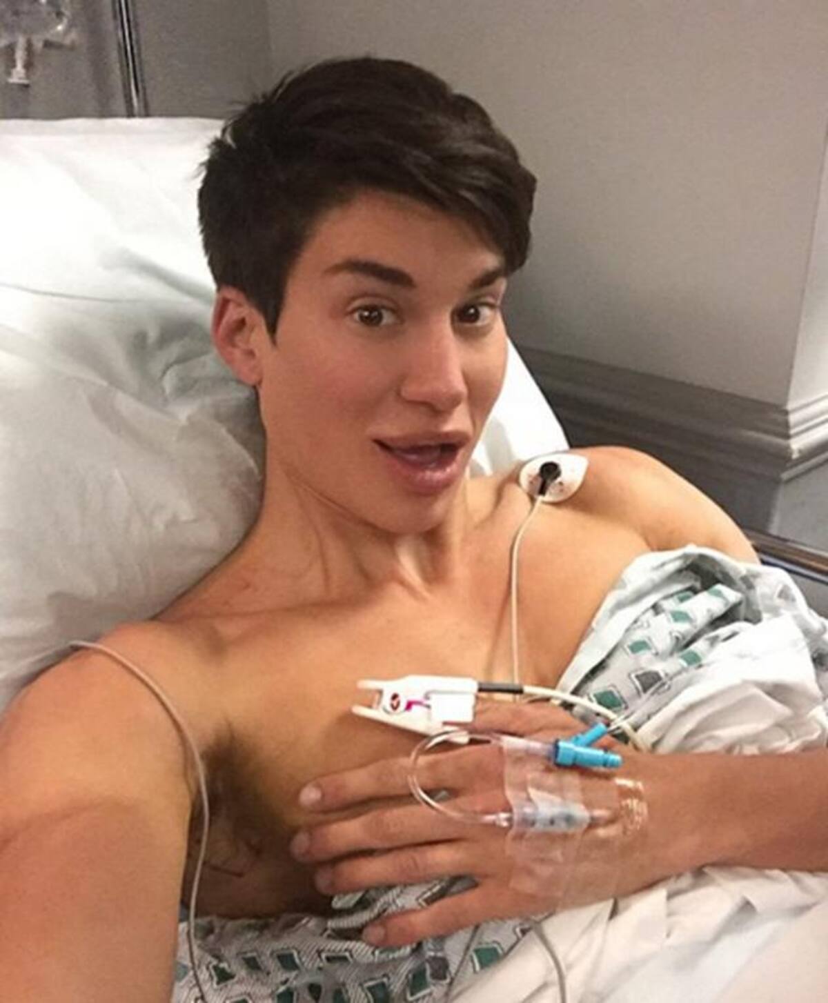 Justin Jedlica se operó para remover tres venas de su frente, intervención que lo pudo dejar ciego. Fotos: Instagram.