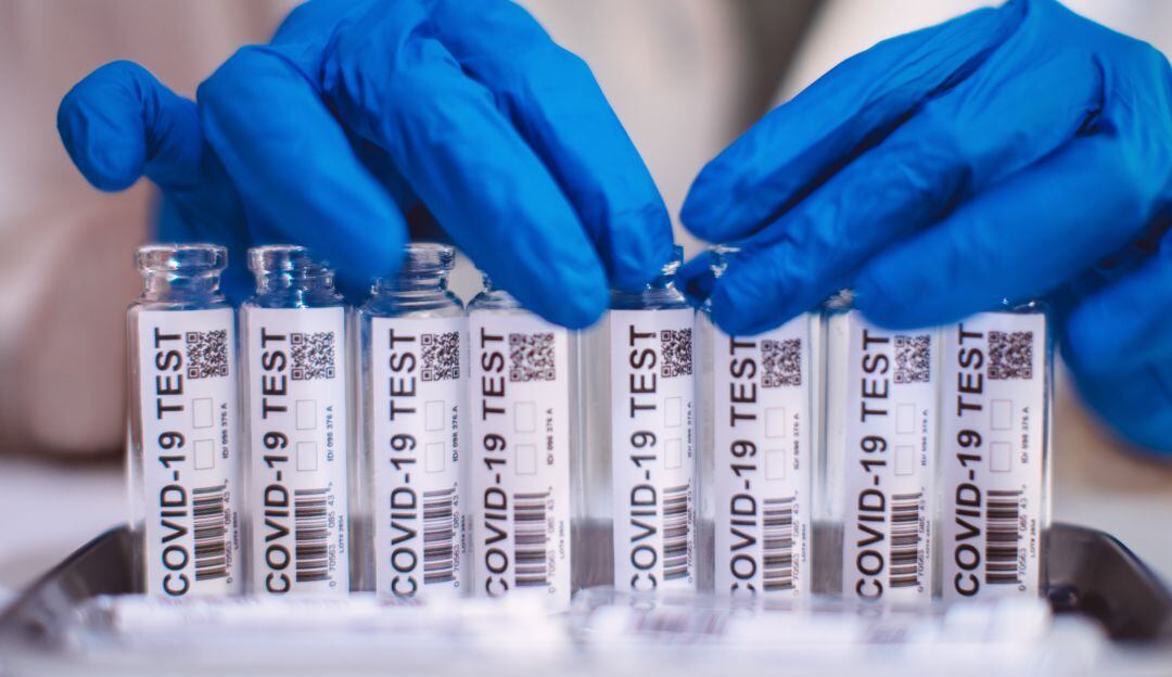 Pruebas contra el Covid-19