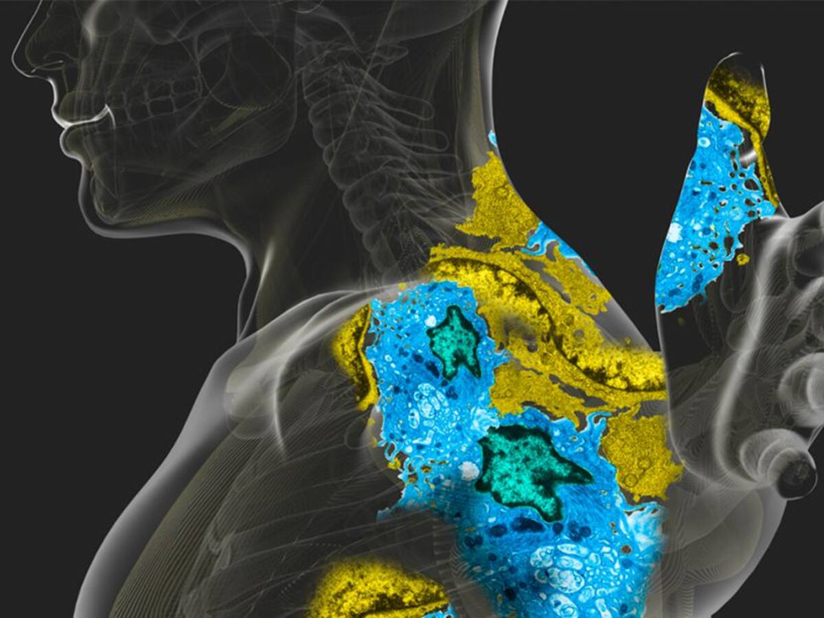 Retiro voluntario de producto farmacéutico del mercado