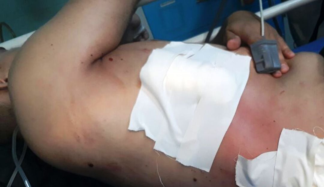 A puñaladas hirieron a hombre en el barrio Las Lomas de Cartagena