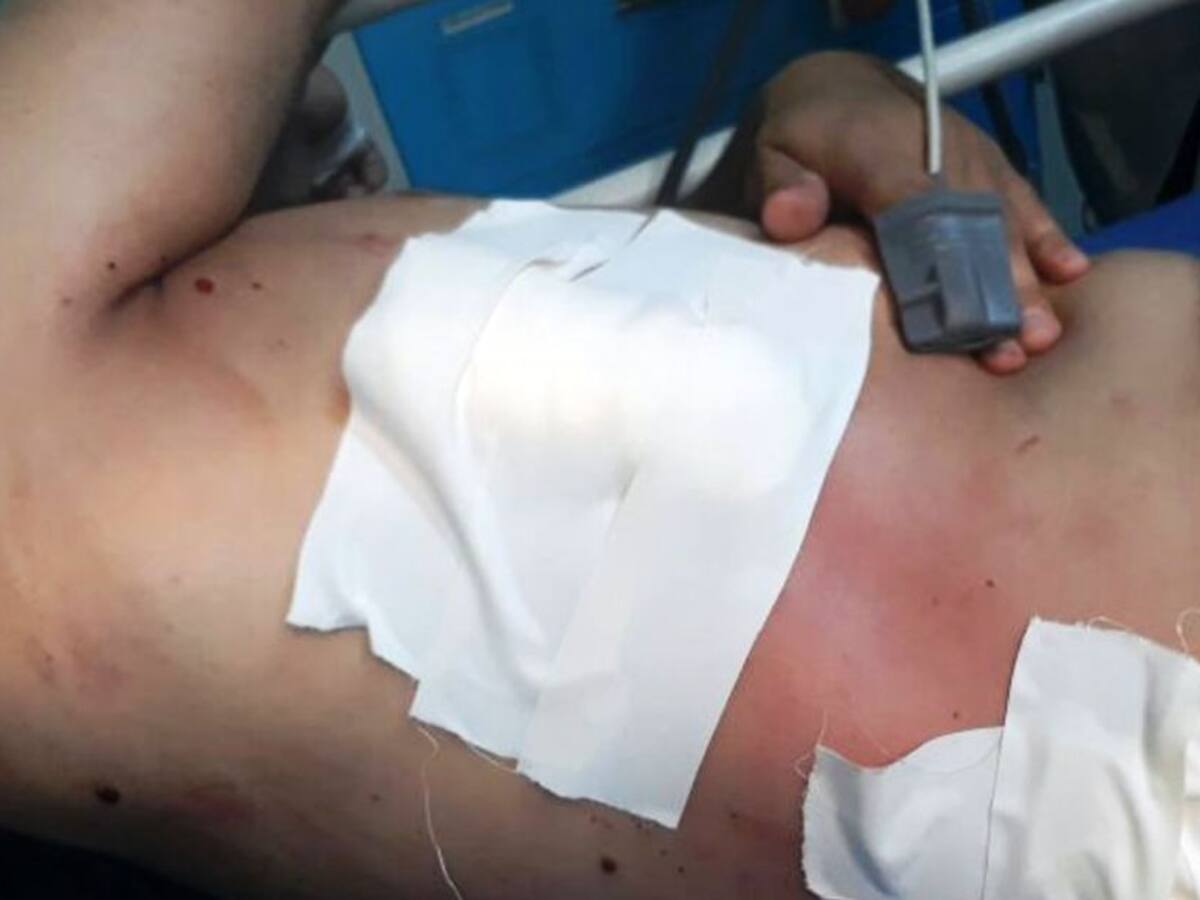 A puñaladas hirieron a hombre en el barrio Las Lomas de Cartagena