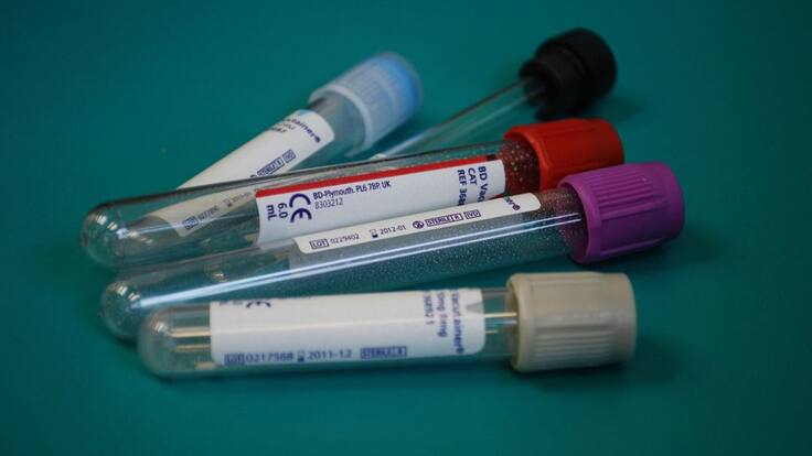 La hemofilia no detiene la vida.