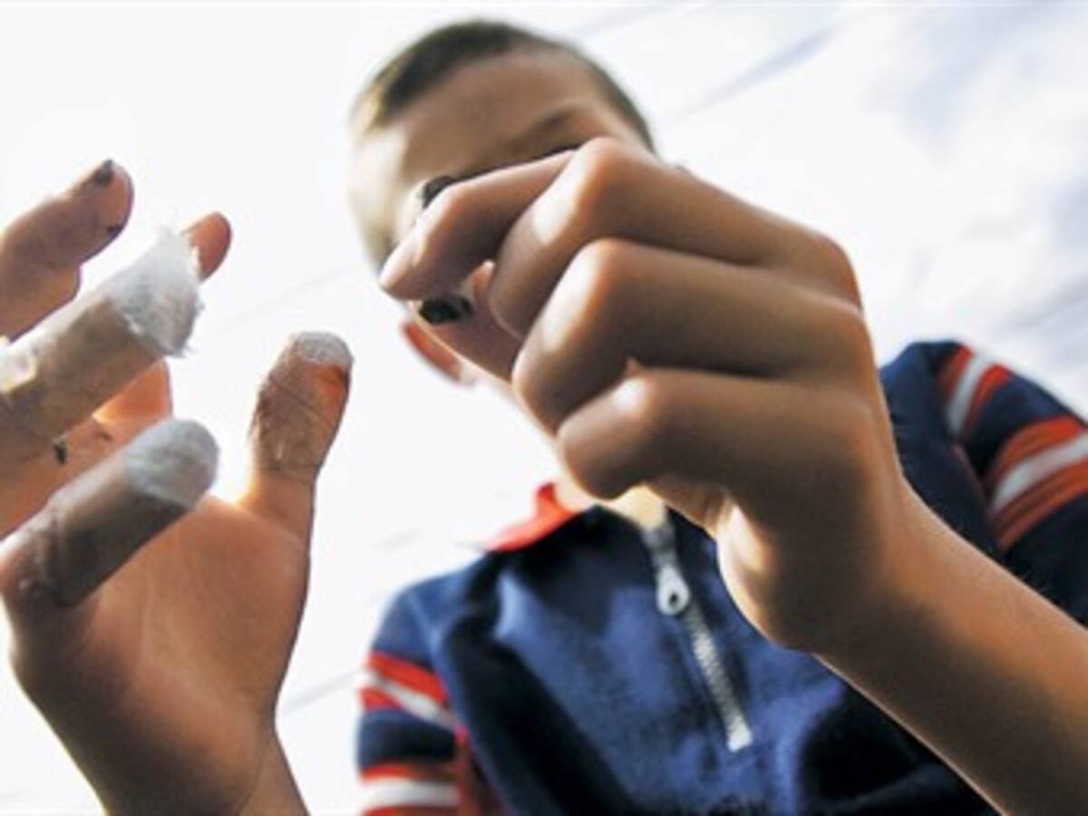 Brigada filantrópica para atender a los niños quemados con pólvora