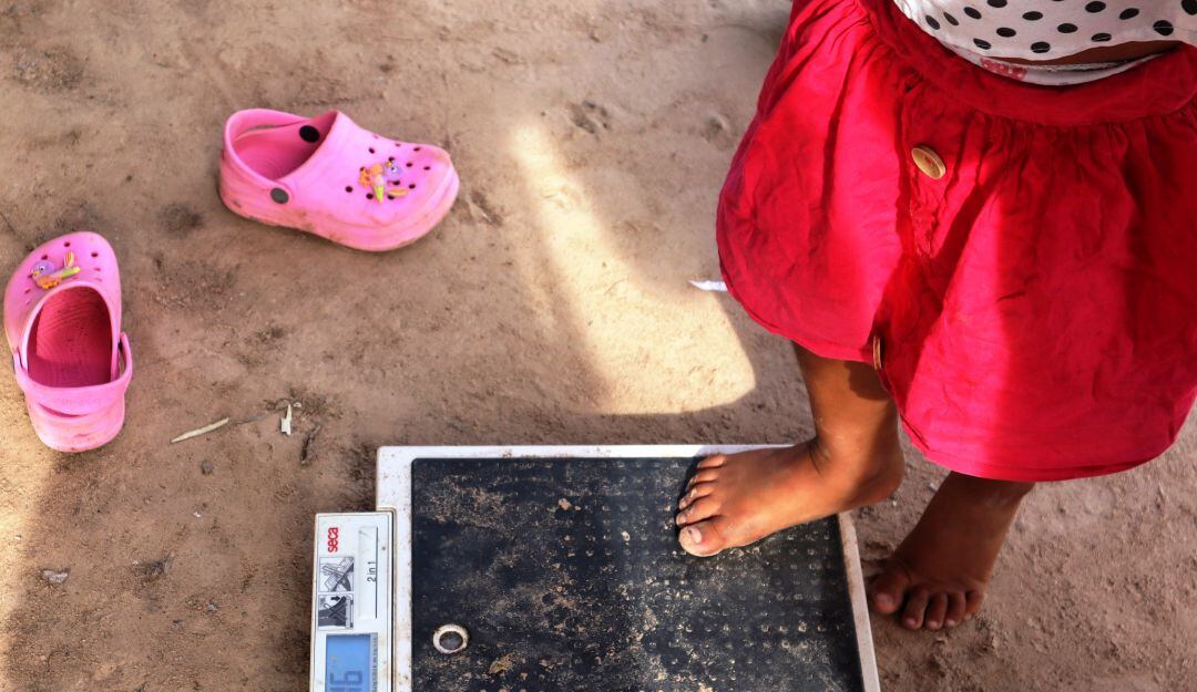 Hasta la semana epidemiológica 19 del 2022 se han reportado ante el Sistema de Vigilancia y Control un total de 73 casos